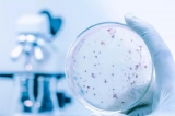 科普丨細菌耐藥知多少